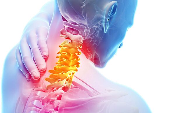 Servikal osteoxondroz