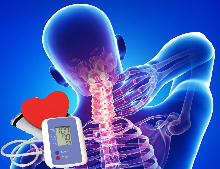 Servikal osteokondroz bilan qon bosimining sakrashi