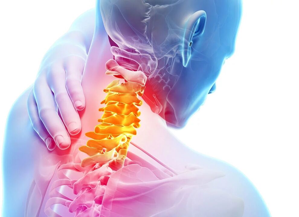 Servikal osteoxondroz